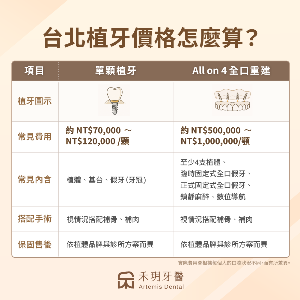 台北植牙費用怎麼算