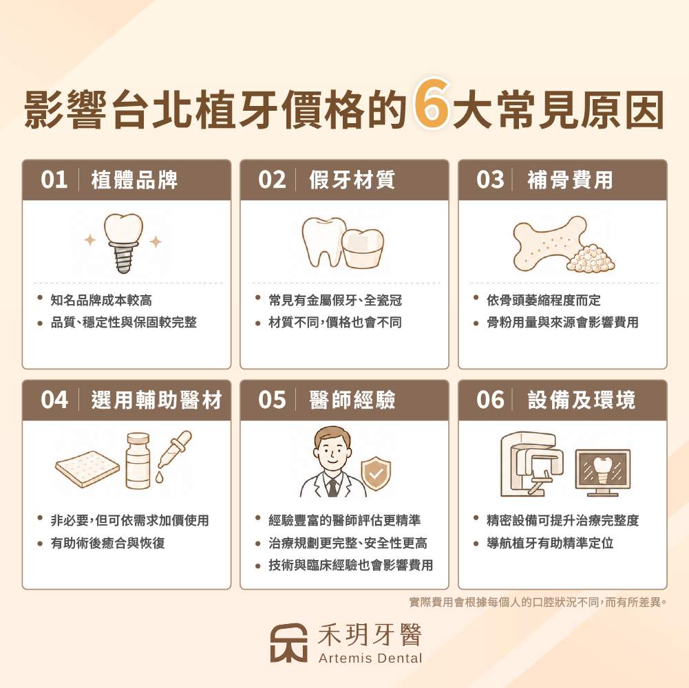 影響植牙價格的常見6原因